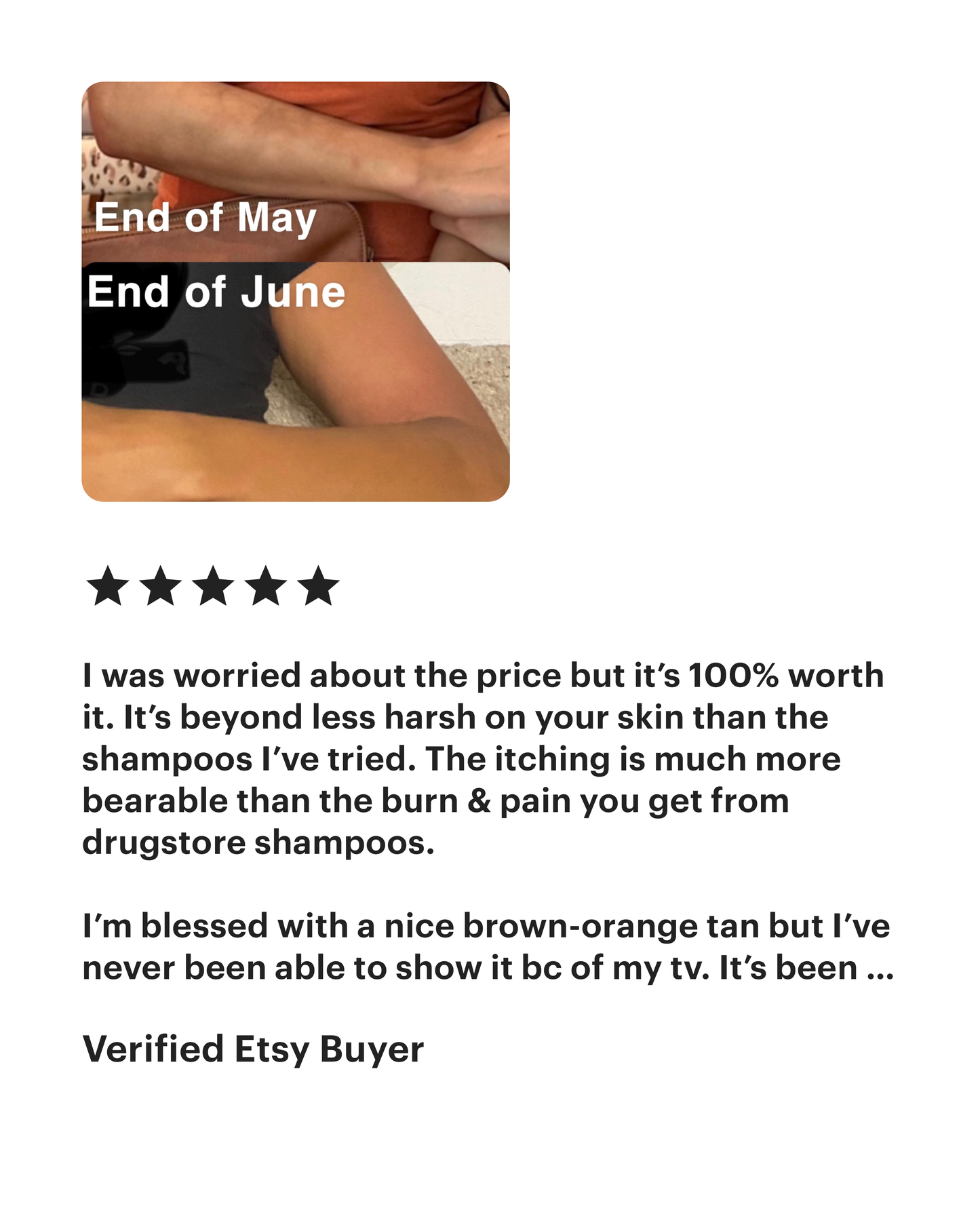 Tinea Free Spray 8oz